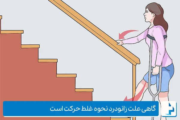 علت زانو درد هنگام پایین رفتن از پله