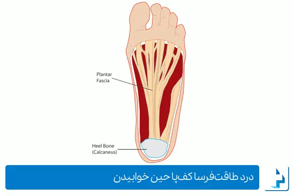 علت اصلی درد کف پا چیست؟