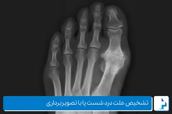 علت درد انگشت شست پا چیست؟