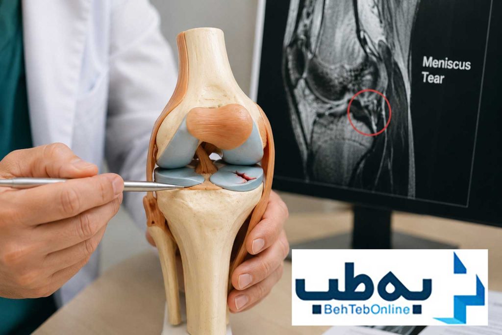 ساییدگی مفاصل باعث التهاب زانو می شود